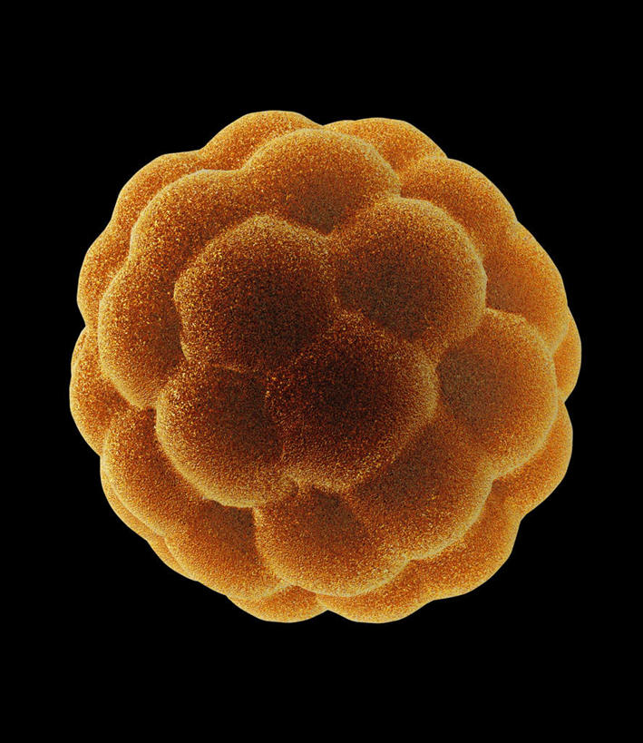 无人,竖图,插画,室内,白天,正面,数码,科技,阴影,黑色背景,网络,医学,高光,几何,计算机图形,合成,图画,画,球,黄色,球体,电脑合成图,数码合成图,生物学,漫画,生理学,写实,具体,具象,囊胚,彩图